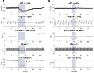 Short-pulsed micro-magnetic stimulation of the vagus nerve